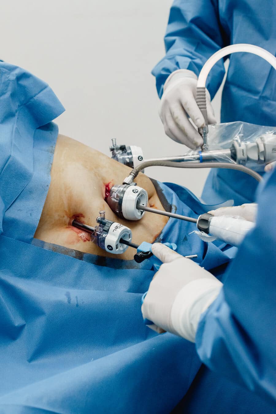 In-progress surgical procedure at the highly-regarded JL Prado Surgical Center
