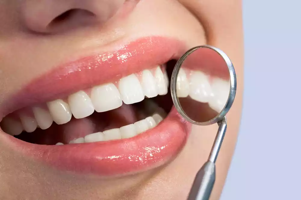 white teeth