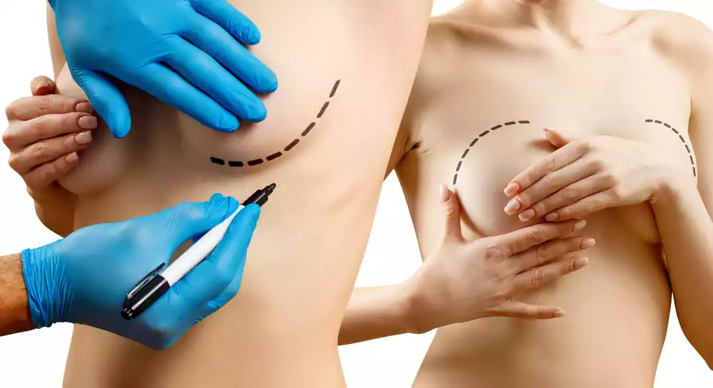 breast surgery (2)