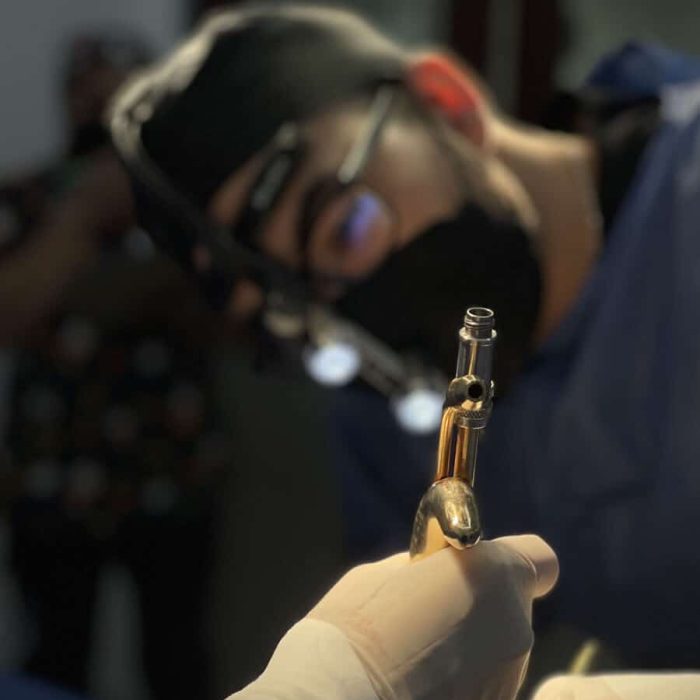 Surgeon focused on a procedure, with the patient's hand and medical equipment visible in the foreground